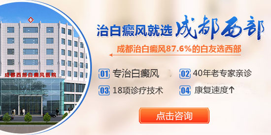 成都比较好的白癜风医院