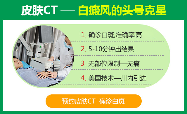 成都的白癜风医院哪家好