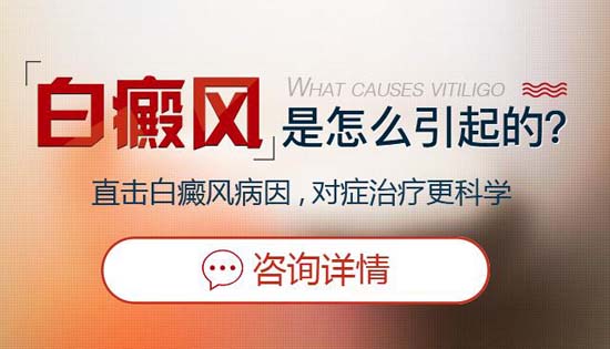 成都白癜风哪个医院好