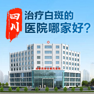 白癜风常识