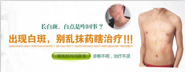 成都治白癜风哪家医院最好