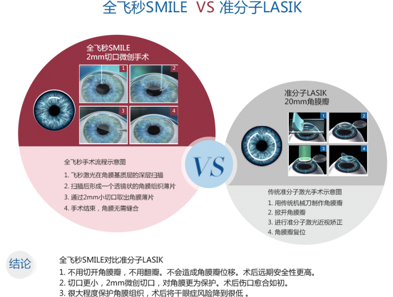 临沂做全飞秒多少钱,术后效果怎样?_全飞秒激光_屈光