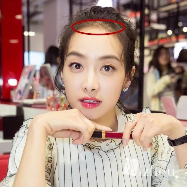 女生发际线太太太高是种怎样的人生体验