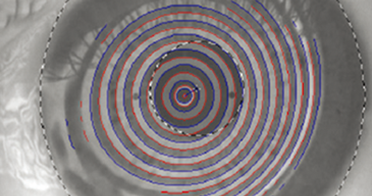 优视手术2.png 优视手术2.png