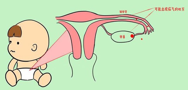 小肠"生气"就是疝气? 不听专业医生的话,家长悔不当初