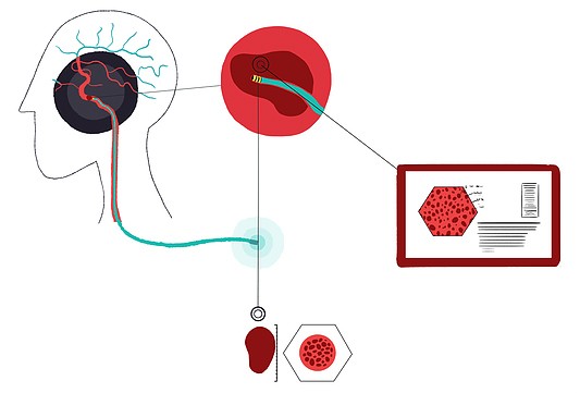 Sensome-stroke-sensor.jpg