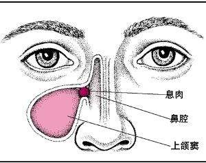 鼻甲肥大1.jpg