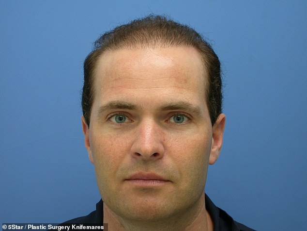 31916240-0-David_said_people_would_look_at_his_hairline_and_give_him_a_stra-a-25_1597337297975.jpg