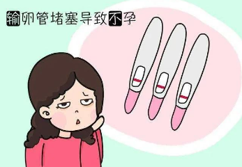 关于输卵管堵塞，大多数人都不知道这个你知道吗？