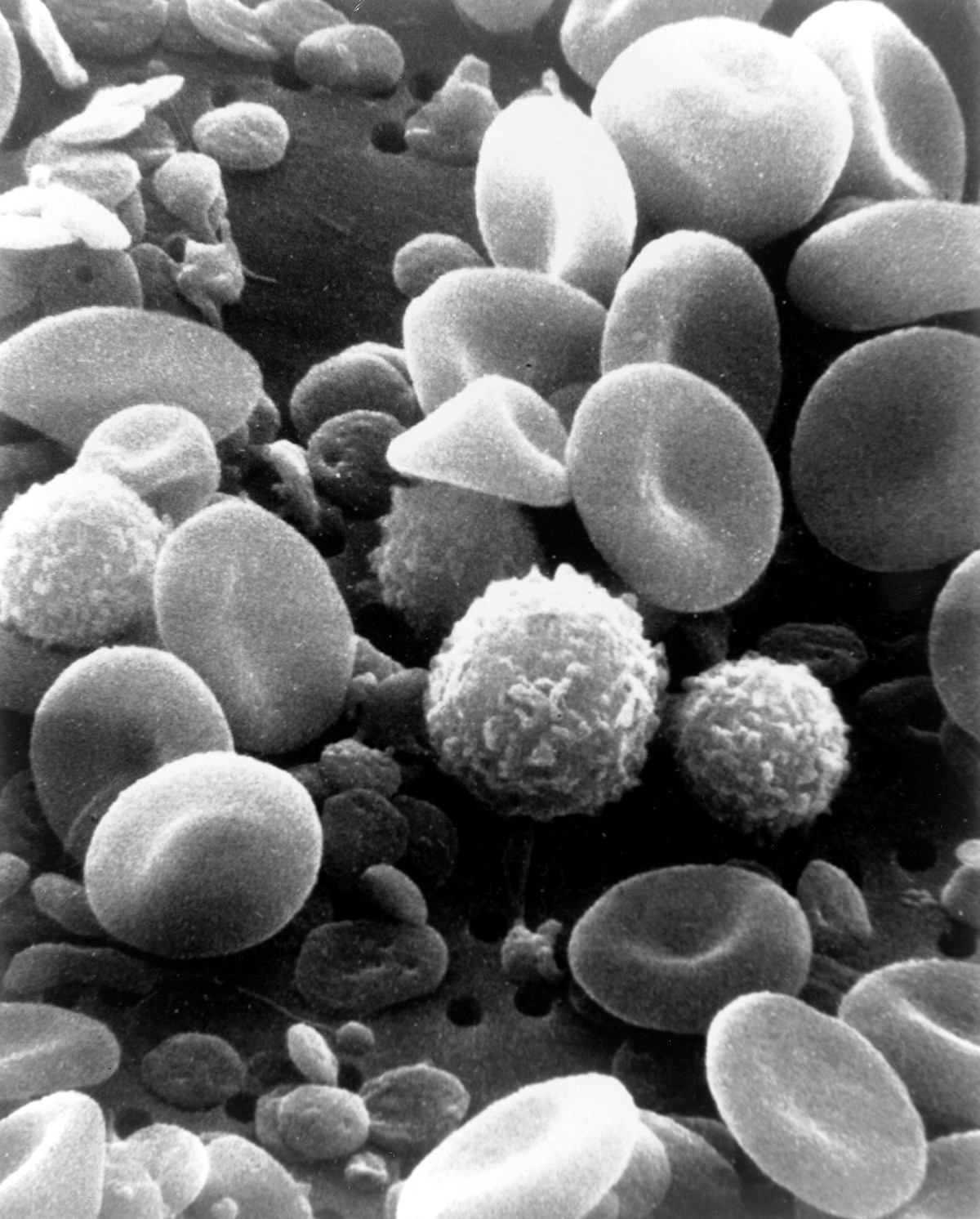 stockvault-blood-cells201290.jpg